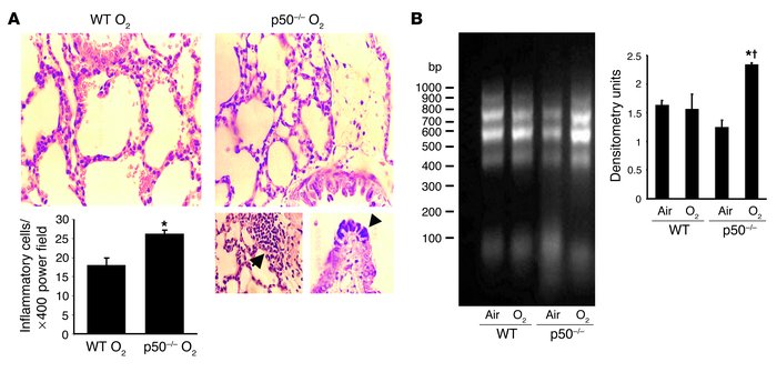 Lung injury in neonatal p50–/– mice after hyperoxia. (A) Upper panels: R...