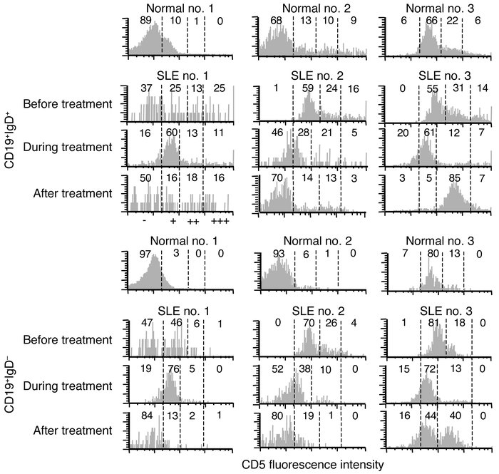 CD5 subsets of peripheral B cells diminish following treatment with huma...
