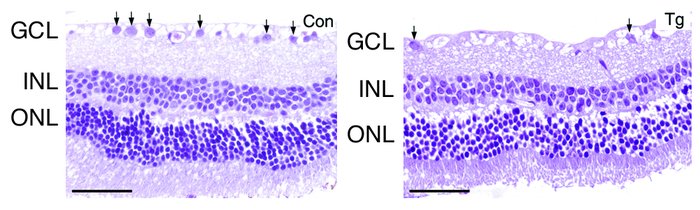 Ganglion cell loss in transgenic retina. Histological sections of retina...