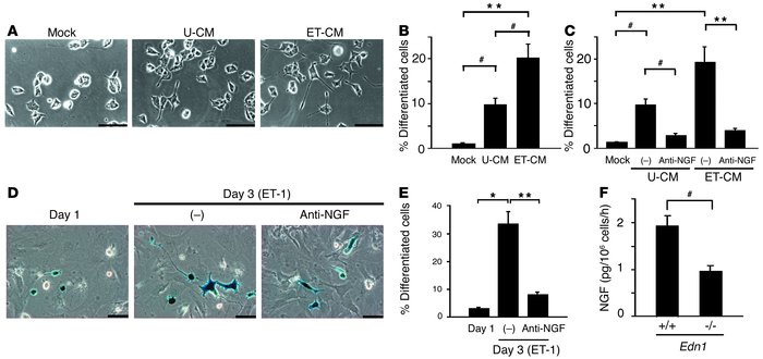 ET-1 causes NGF-mediated differentiation of PC12 cells. (A) PC12 cell mo...