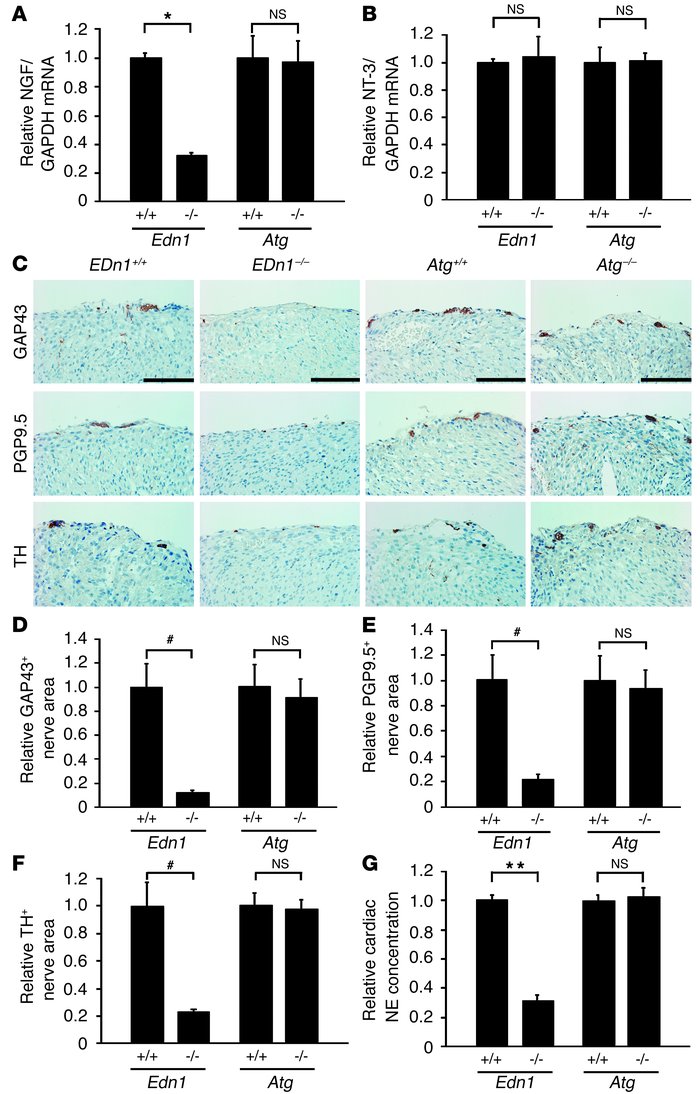 Disruption of ET-1, but not of angiotensinogen, reduces NGF expression, ...