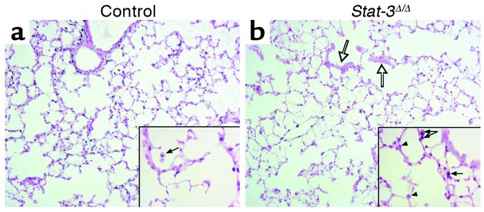 STAT-3 immunohistochemistry after exposure to 95% oxygen. Lungs from con...