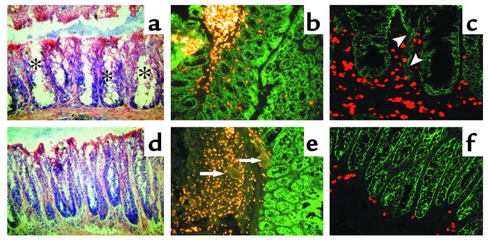 Cryosections of colon (×100) from three, independent, infected WT (a–c) ...