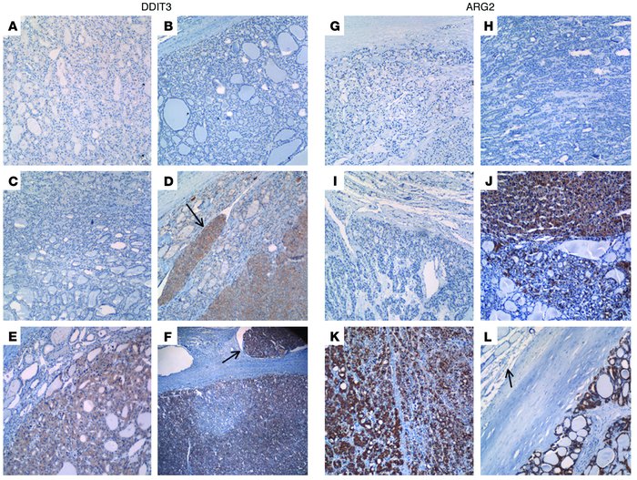 Immunohistochemical analysis of DDIT3 (A–F) and ARG2 (G–L) in paraffin-e...