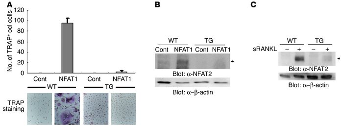 Impairment of osteoclastogenesis and NFAT2 induction by NFAT1 overexpres...