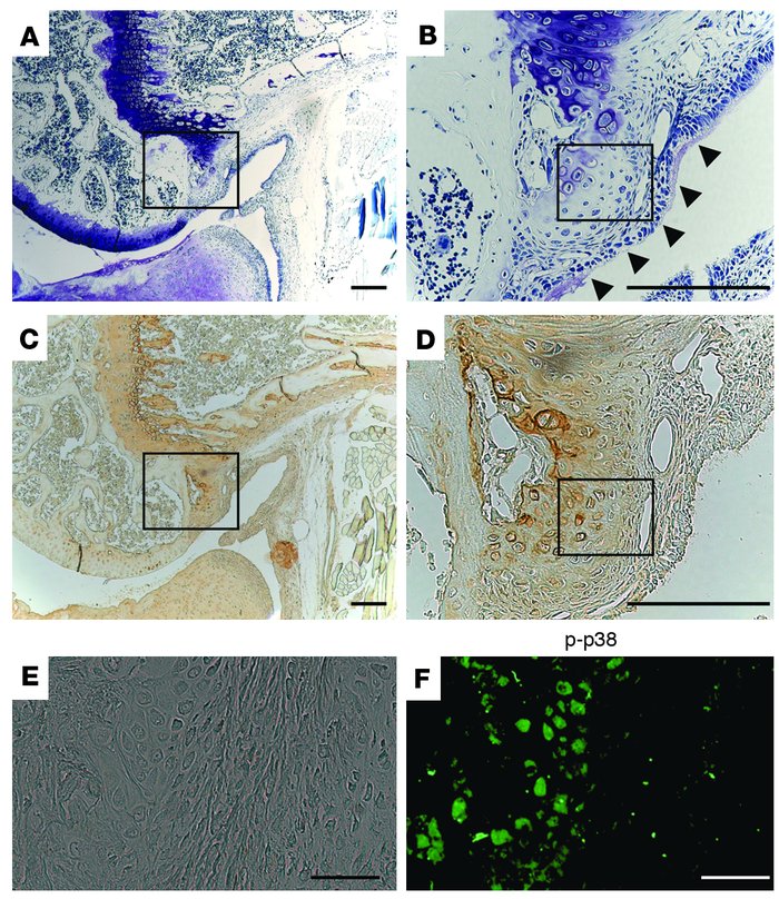 Histological analysis of knee joints in the mouse ACL and MM resection m...