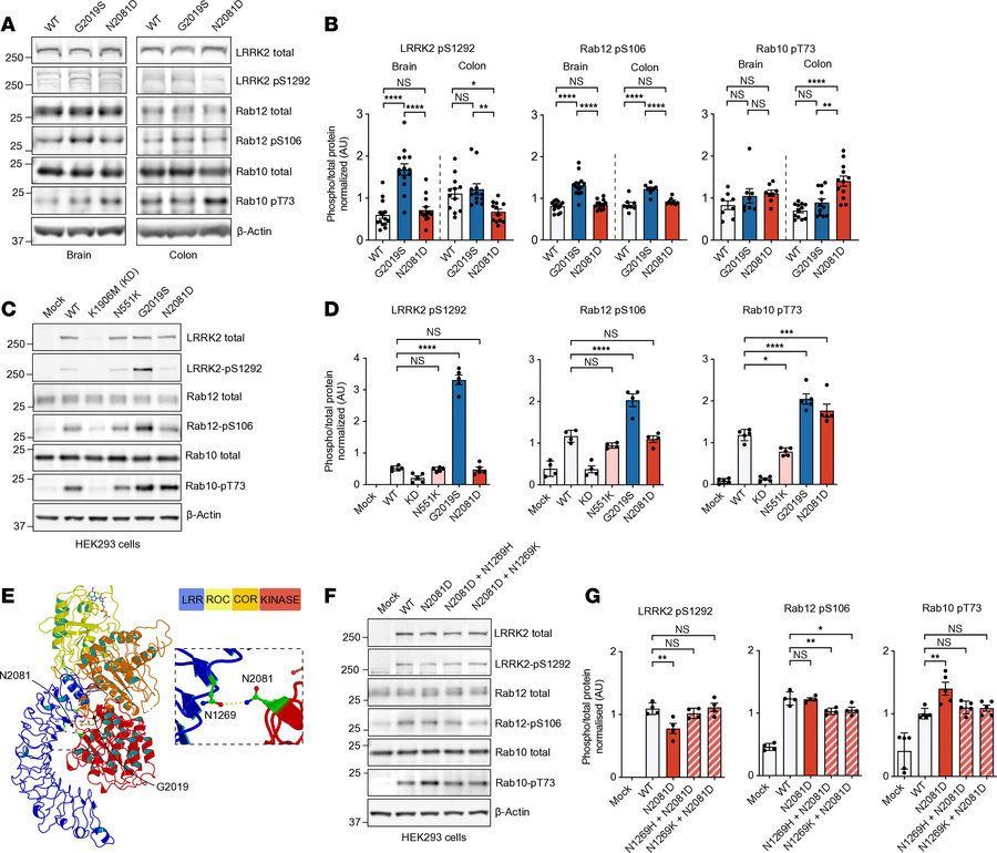 Kinase activity characterization of PD- and CD-linked LRRK2 variants.
(A...