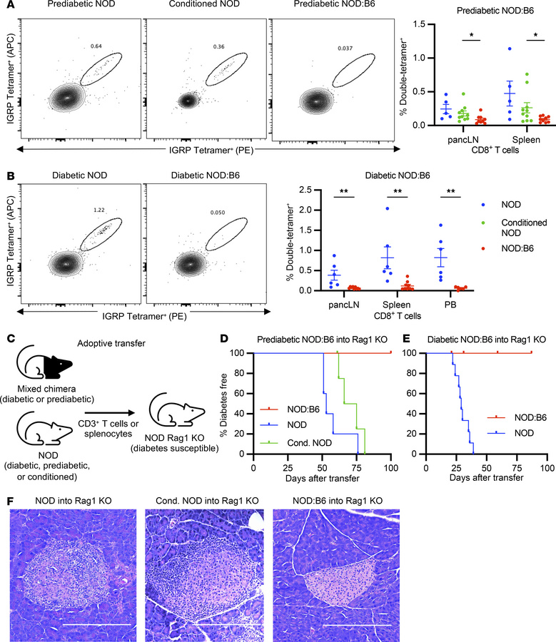 T cell autoimmunity is corrected in prediabetic and diabetic chimeras.
(...