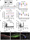 Curing autoimmune diabetes with allogeneic hematopoietic cell and islet tra