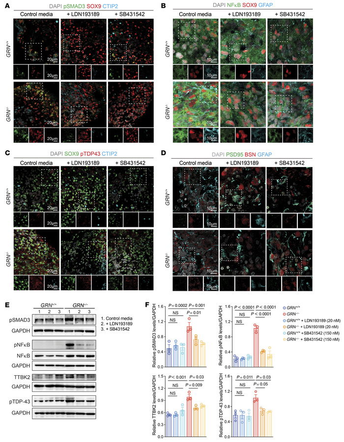 Inhibition of TGF-β signaling reduces pTDP-43 in GRN–/– astrocytes and r...