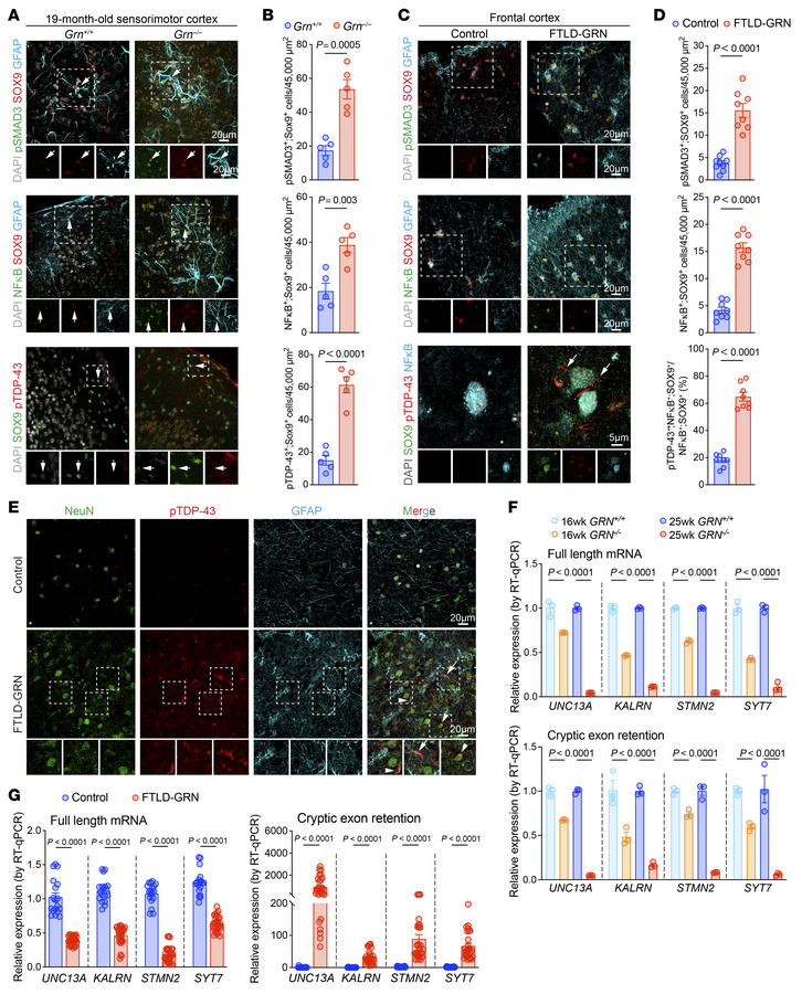 Conserved TGF-β activation in PGRN-deficient astrocytes is independent o...