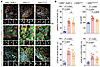 TGF-β activation and pTDP-43 in GRN-mutant astrocytes in GRNR493X/+ and GRN