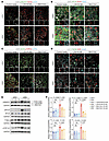 Inhibition of TGF-β signaling reduces pTDP-43 in GRN–/– astrocytes and rest