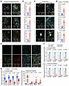 Conserved TGF-β activation in PGRN-deficient astrocytes is independent of c