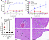 Simultaneous CRISPR/Cas9 targeting inhibits tumor growth.