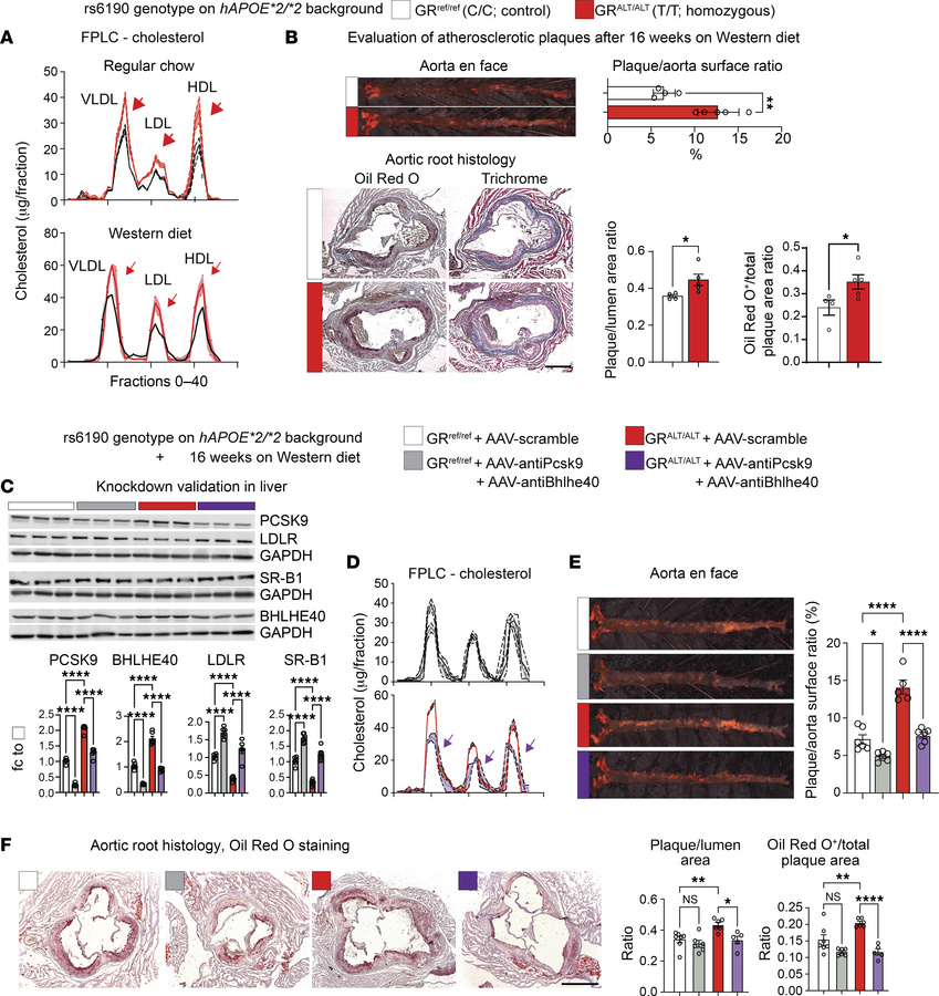The SNP promotes atherosclerosis in vivo.
(A) FPLC curves show the addit...