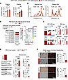 The rs6190 SNP is sufficient to increase cholesterol and skew the liver GR