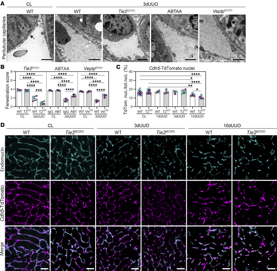 Pharmacological or genetic TIE2 activation prevents UUO-induced endothel...