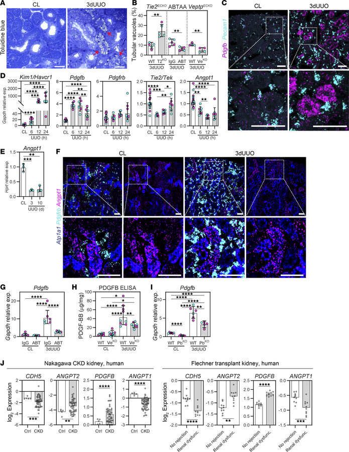 Pharmacological or genetic TIE2 activation prevents UUO-induced tubular ...
