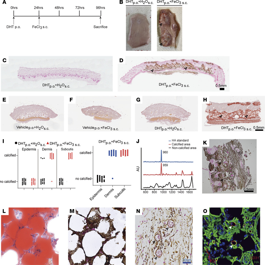 A rodent model of ectopic cutaneous calcification.
(A) Sprague-Dawley ra...