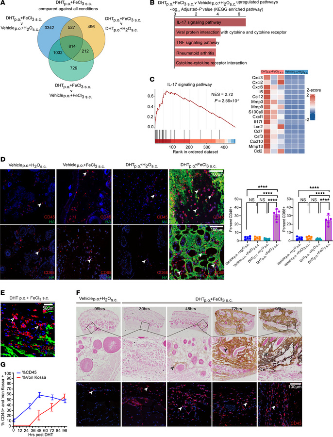 Inflammation is prominent and precedes calcific mineral deposits.
(A) Ve...