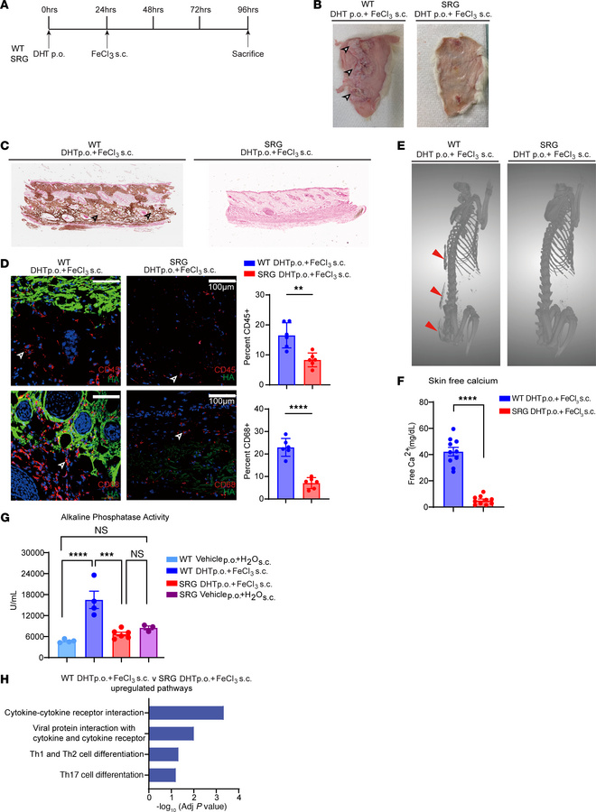 Genetic deletion of B, T, and NK cells (SRG rats) inhibits the formation...