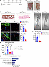 Genetic deletion of B, T, and NK cells (SRG rats) inhibits the formation of