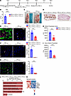 Cyclophosphamide-induced leukopenia rescues ectopic calcification.