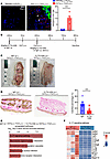 IL-17a blockade prevents skin calcification and inflammation in the DHT+FeC
