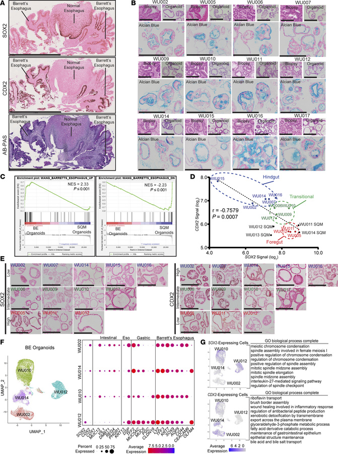 Barrett’s esophagus heterogeneity correlates with SOX2 abundance.
(A) Hu...