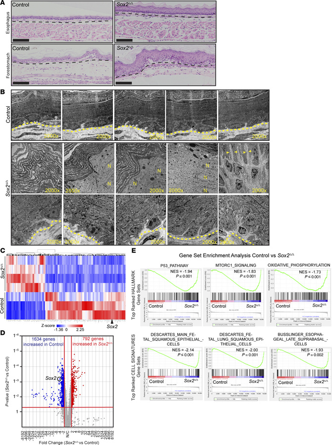 Loss of Sox2 in the foregut squamous epithelium induces histological and...