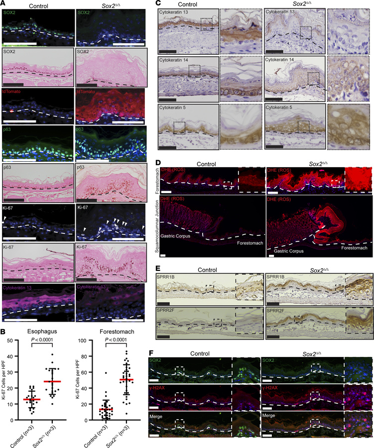 Loss of Sox2 in the foregut squamous epithelium results in increased pro...