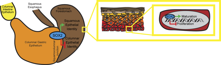 Diagram summarizing the role of SOX2 in murine foregut squamous epitheli...