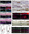 Loss of Sox2 in the foregut squamous epithelium results in increased prolif