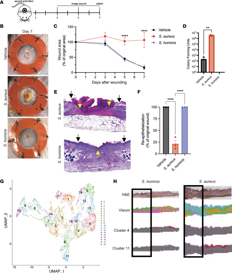 
S. aureus, not S. hominis, delays cutaneous wound healing.
(A) Schema o...
