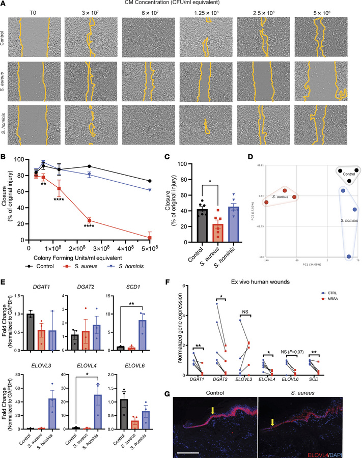 
S. aureus inhibits keratinocyte function and expression of genes involv...