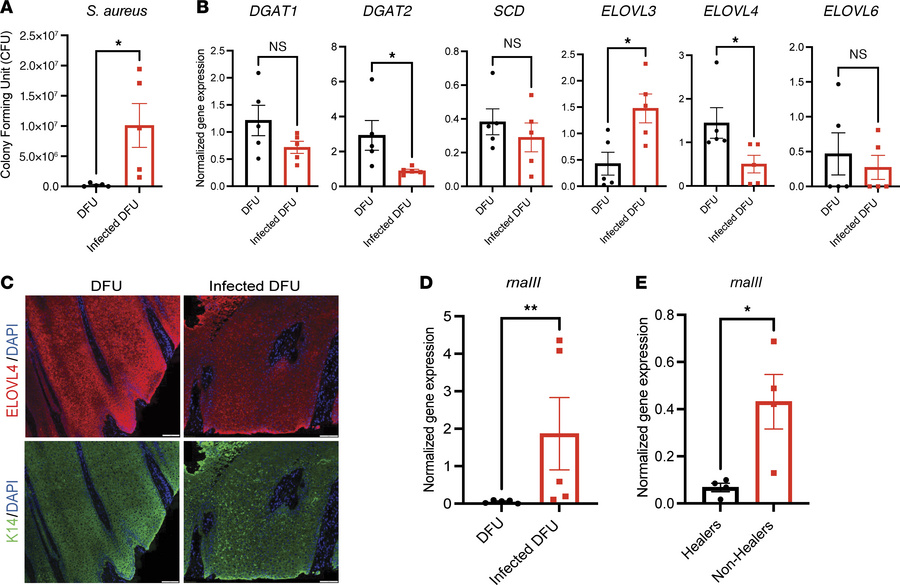 Human wounds demonstrate decreased lipid enzymes in the presence of S. a...