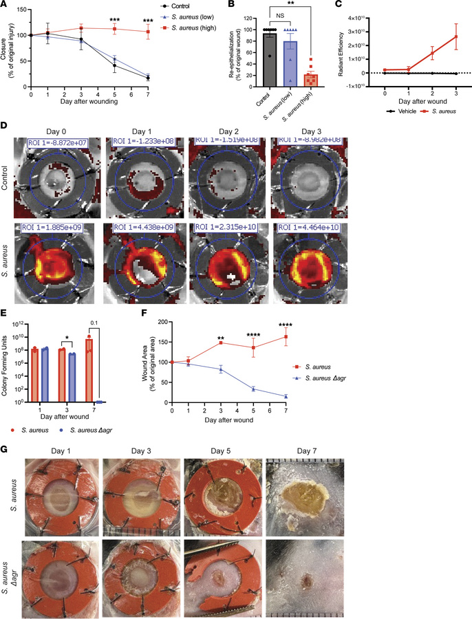 Activation of agr quorum sensing in S. aureus inhibits wound healing.
(A...