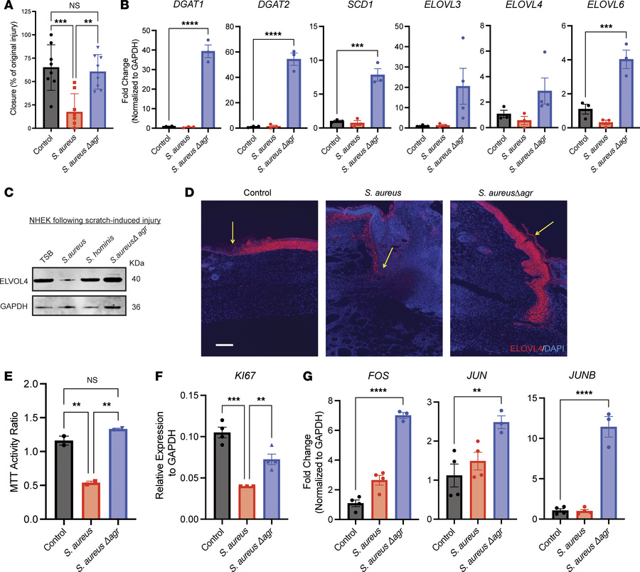 
S. aureus agr system influences keratinocyte function and gene expressi...