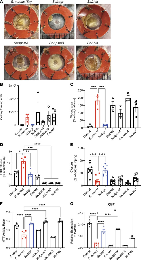 Differential effects on wound healing and gene expression by specific pr...