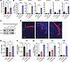 S. aureus agr system influences keratinocyte function and gene expression.