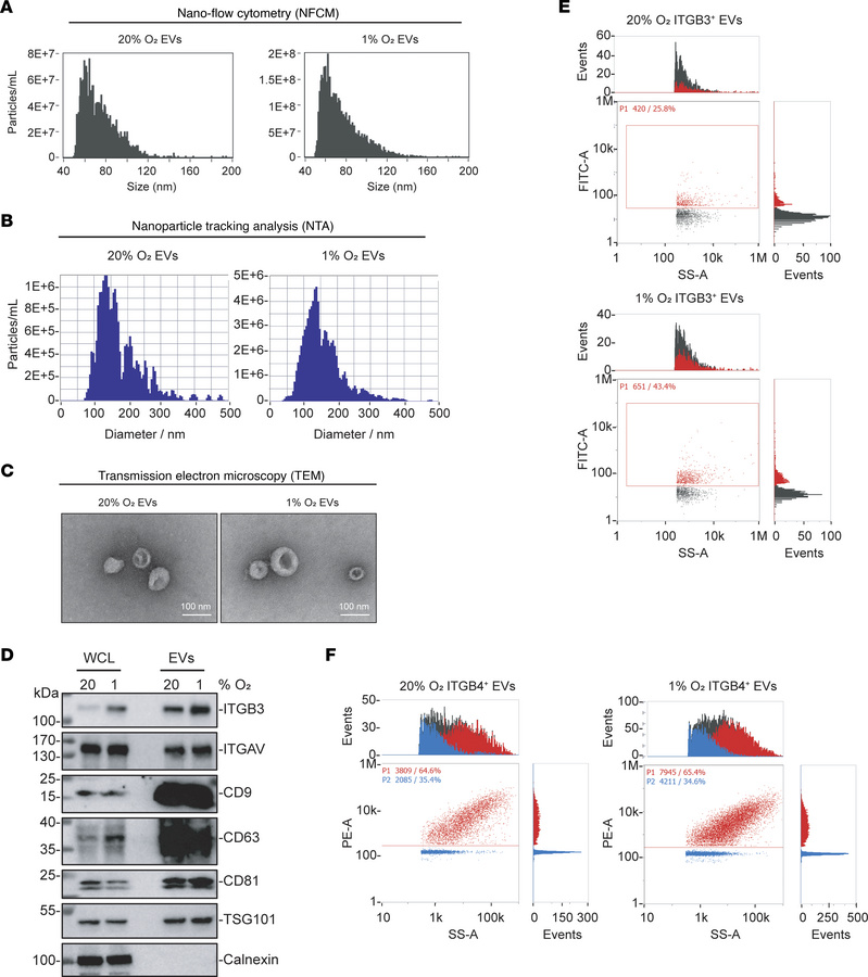 ITGB3 is exported from BC cells via EVs.
(A and B) MDA231-BrM2 cells wer...