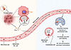 HIF-1–dependent expression of ITGB3 incorporated into EVs promotes BC brain