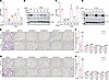 ITGB3 expression is required for hypoxia-induced migration and invasion of