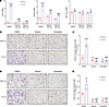 Pharmacological inhibition of HIF-1 or ITGB3 impairs migration and invasion