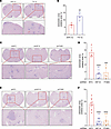 HIF-1–induced ITGB3 expression is required for colonization of brain by BC