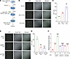 ITGB3+ EVs promote interaction of BC cells with ECs and increase endothelia