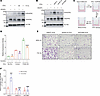 ITGB3+ EVs increase permeability of brain ECs by augmenting VEGFR2 signalin