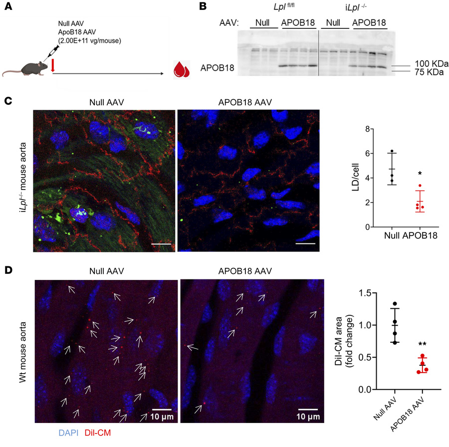 Treatment with APOB18-AAV inhibits aortic EC chylomicron uptake in vivo....