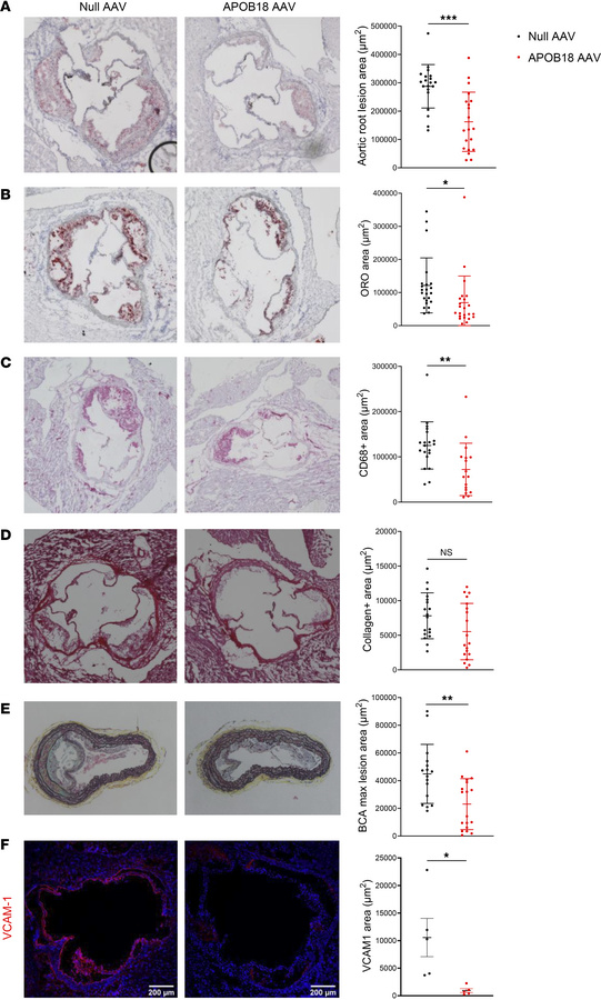 Treatment with APOB18-AAV reduces atherosclerosis.
Ldlr–/– mice were inj...